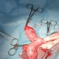 Miňonka během operace