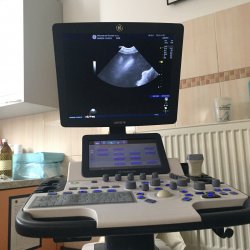 Během sonografického vyšetření