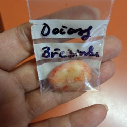 Březinčin močový kámen